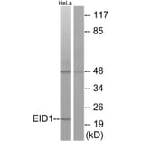 Western Blot - Anti-EID1 Antibody (C11984) - Antibodies.com