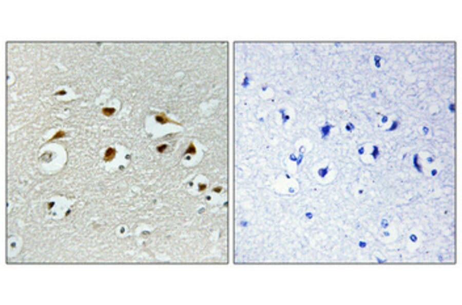 Immunohistochemistry - Anti-EID1 Antibody (C11984) - Antibodies.com