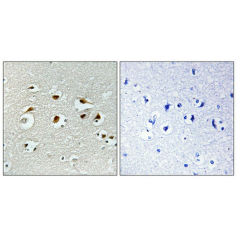 Immunohistochemistry - Anti-EID1 Antibody (C11984) - Antibodies.com