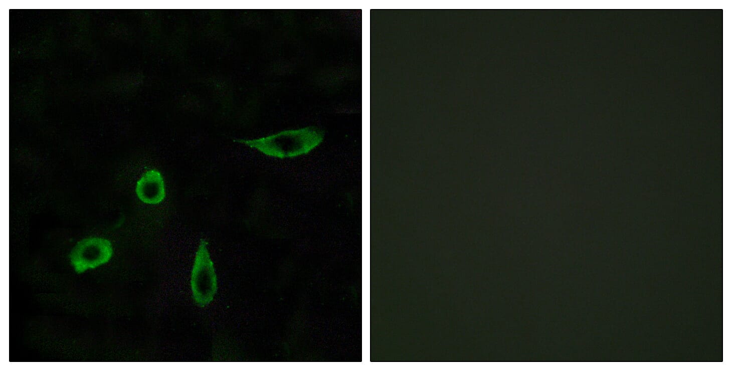 Immunofluorescence analysis of LOVO cells using Anti-EDG4 Antibody. The right hand panel represents a negative control, where the antibody was pre-incubated with the immunising peptide.