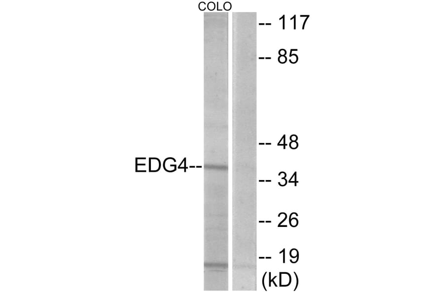 Western Blot - Anti-EDG4 Antibody (G085) - Antibodies.com