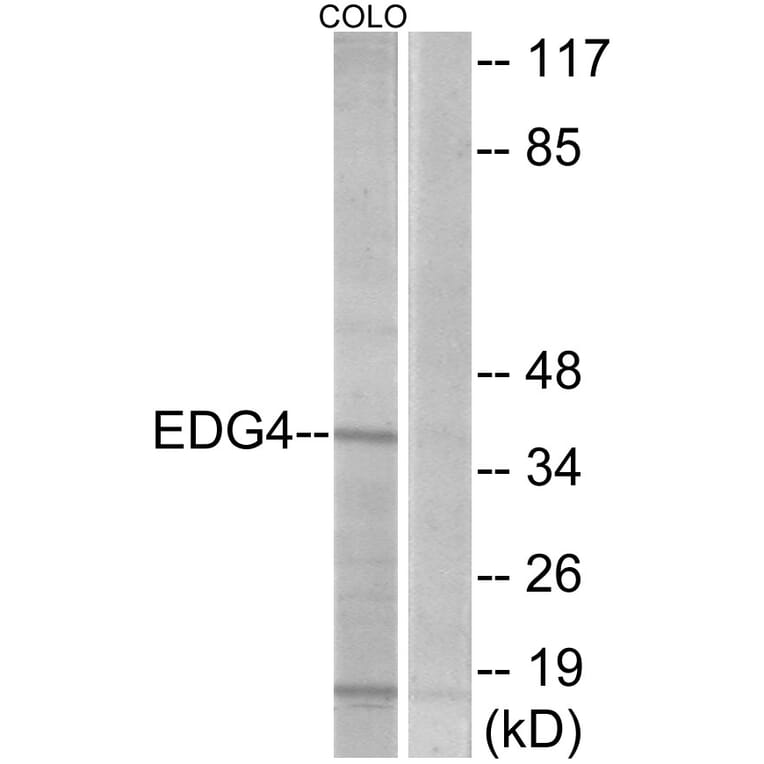 Western Blot - Anti-EDG4 Antibody (G085) - Antibodies.com