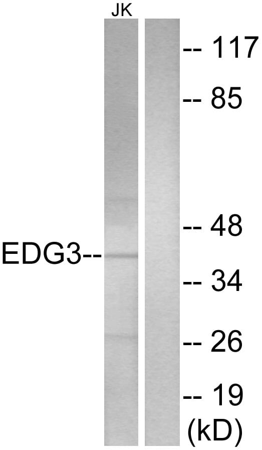 Western blot analysis of lysates from Jurkat cells using Anti-EDG3 Antibody. The right hand lane represents a negative control, where the antibody is blocked by the immunising peptide.