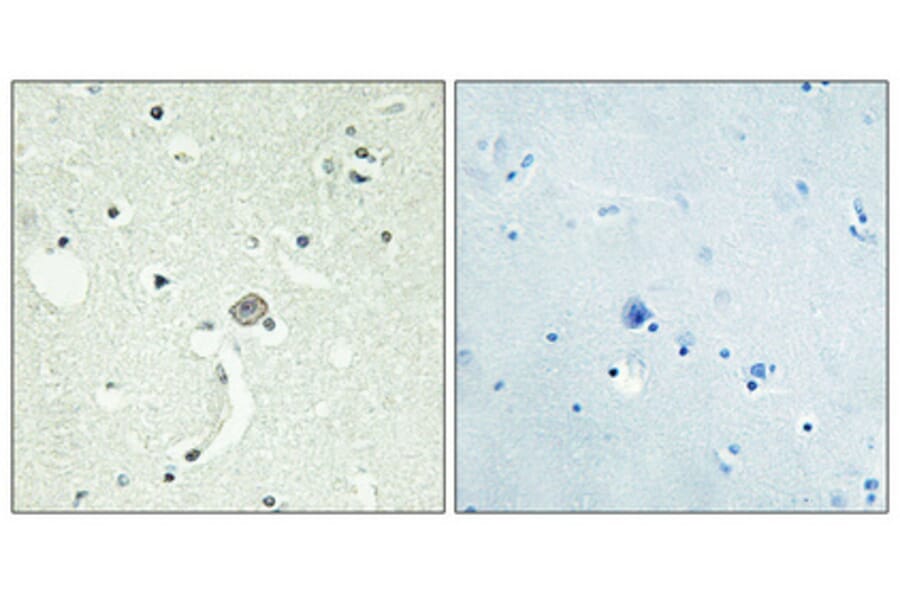 Immunohistochemistry - Anti-EDG1 Antibody (G082) - Antibodies.com