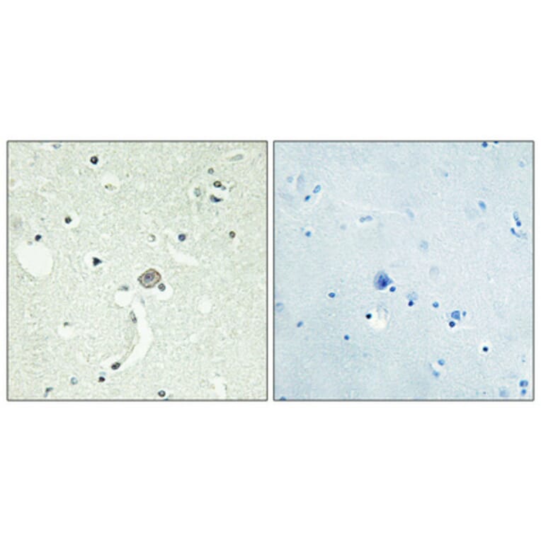 Immunohistochemistry - Anti-EDG1 Antibody (G082) - Antibodies.com