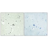 Immunohistochemistry - Anti-EDG1 Antibody (G082) - Antibodies.com
