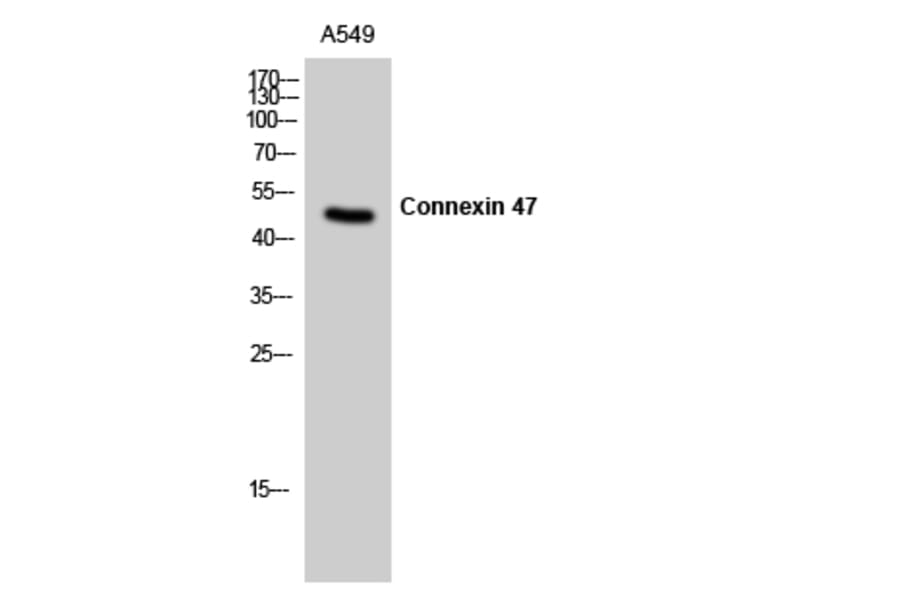 Western Blot - Anti-CXG2 Antibody (C15876) - Antibodies.com