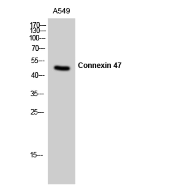 Western Blot - Anti-CXG2 Antibody (C15876) - Antibodies.com