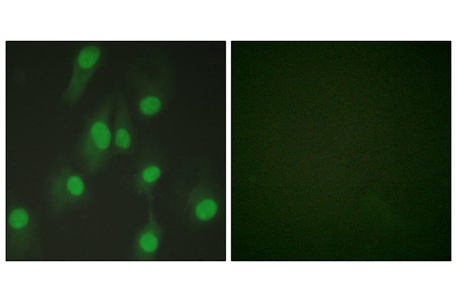 Immunofluorescence - Anti-Chk1 Antibody (B0861) - Antibodies.com