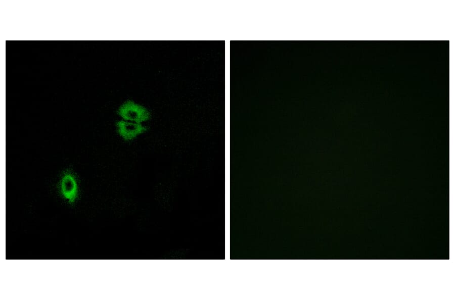 Immunofluorescence - Anti-CCR7 Antibody (G053) - Antibodies.com