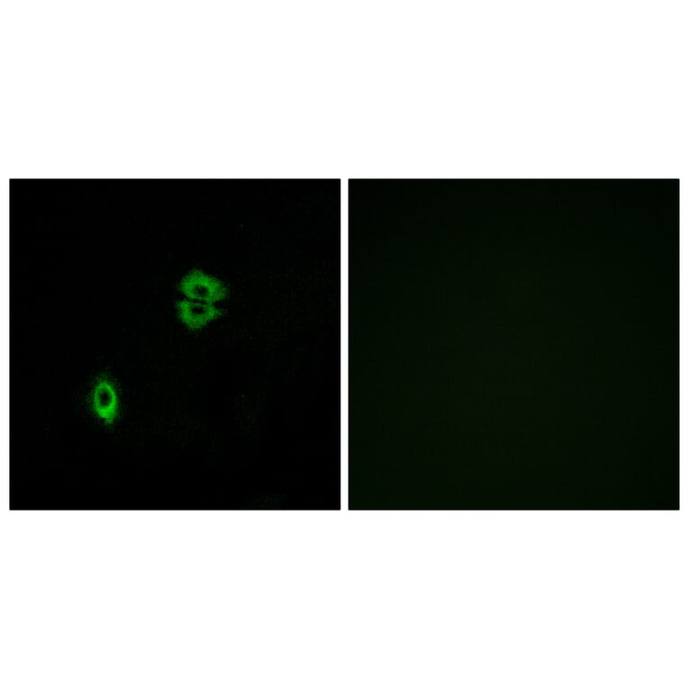 Immunofluorescence - Anti-CCR7 Antibody (G053) - Antibodies.com