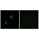 Immunofluorescence - Anti-CCR7 Antibody (G053) - Antibodies.com