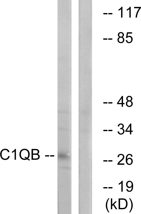 Western blot analysis of lysates from Jurkat cells using Anti-C1QB Antibody. The right hand lane represents a negative control, where the antibody is blocked by the immunising peptide.