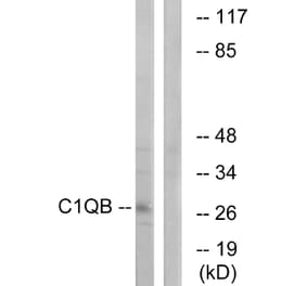 Western Blot - Anti-C1QB Antibody (C15196) - Antibodies.com