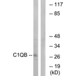 Western Blot - Anti-C1QB Antibody (C15196) - Antibodies.com