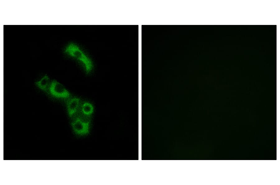 Immunofluorescence - Anti-C1QB Antibody (C15196) - Antibodies.com