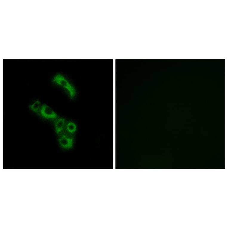 Immunofluorescence - Anti-C1QB Antibody (C15196) - Antibodies.com