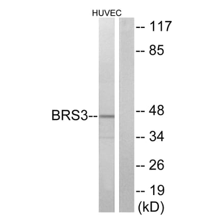 Western Blot - Anti-BRS3 Antibody (G034) - Antibodies.com