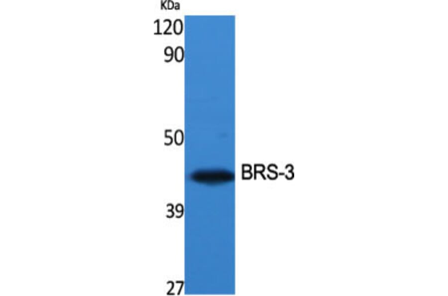 Western Blot - Anti-BRS3 Antibody (G034) - Antibodies.com