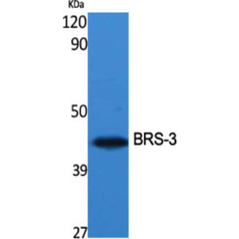 Western Blot - Anti-BRS3 Antibody (G034) - Antibodies.com