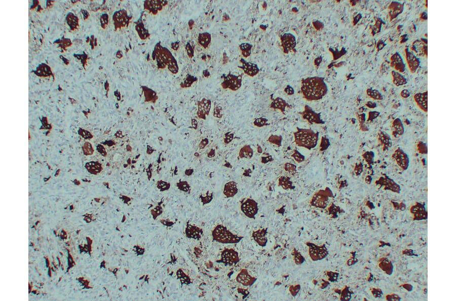 Immunohistochemistry - Anti-TRAP Antibody (V0134) - Antibodies.com