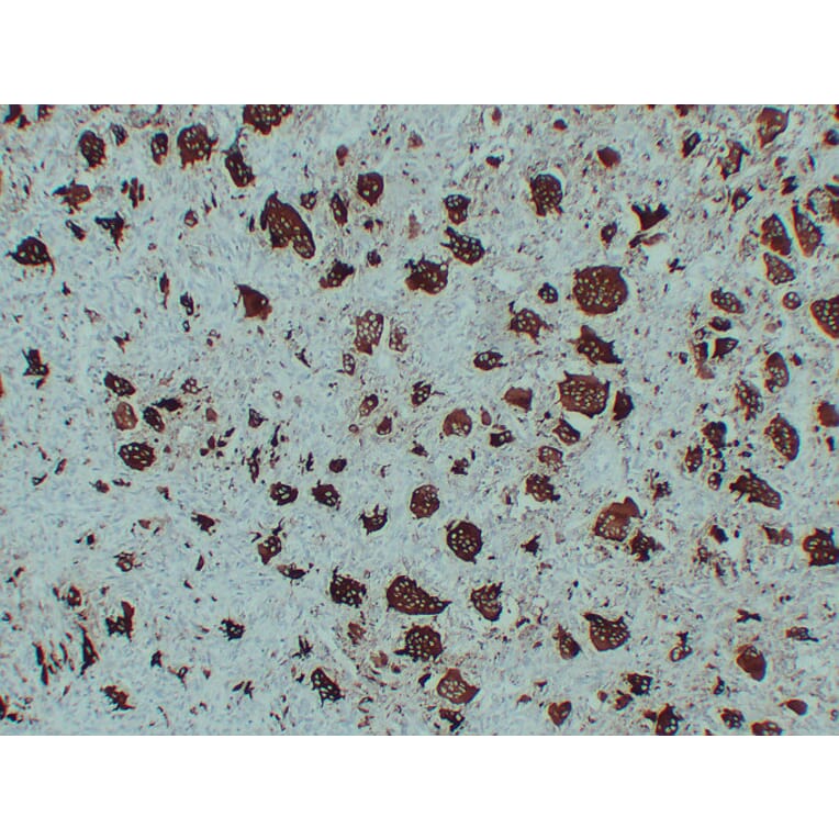 Immunohistochemistry - Anti-TRAP Antibody (V0134) - Antibodies.com