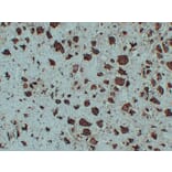 Immunohistochemistry - Anti-TRAP Antibody (V0134) - Antibodies.com