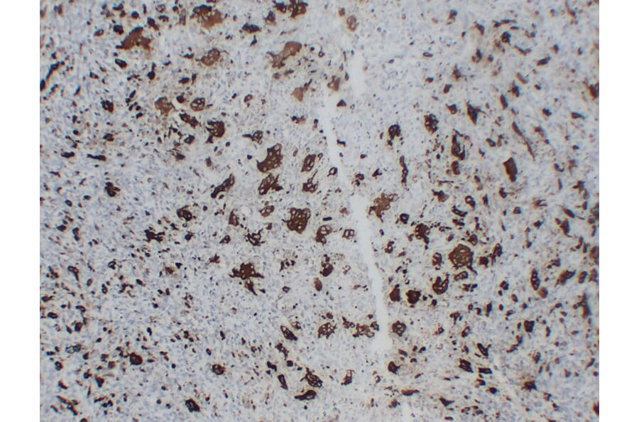 Immunohistochemistry - Anti-TRAP Antibody (V0134) - Antibodies.com