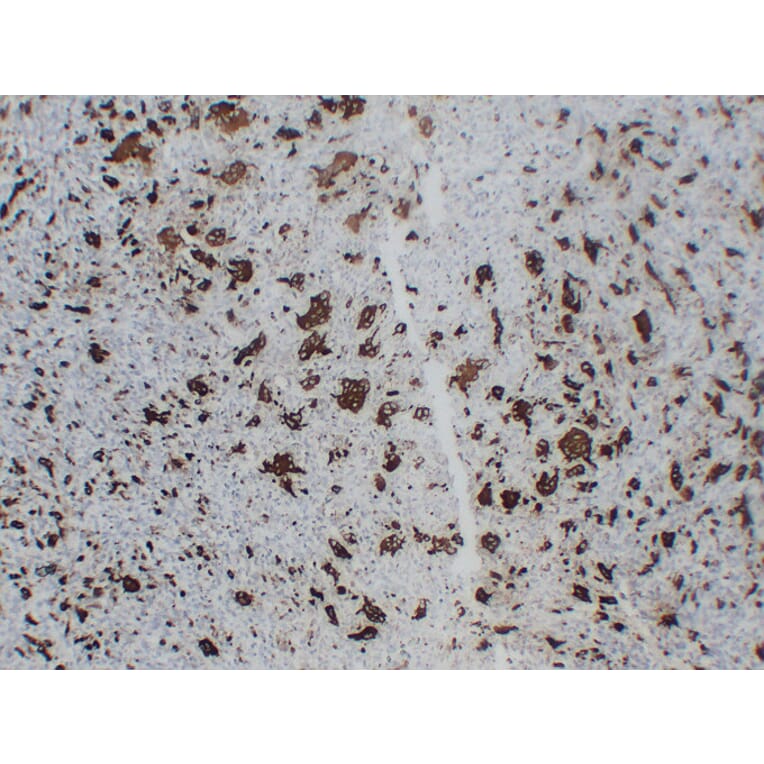 Immunohistochemistry - Anti-TRAP Antibody (V0134) - Antibodies.com