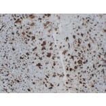 Immunohistochemistry - Anti-TRAP Antibody (V0134) - Antibodies.com