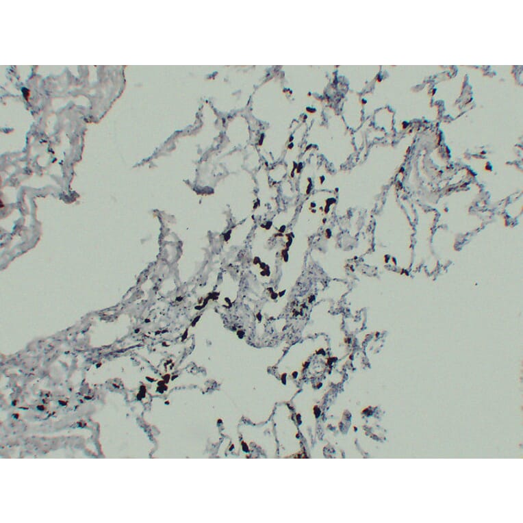 Immunohistochemistry - Anti-TRAP Antibody (V0134) - Antibodies.com
