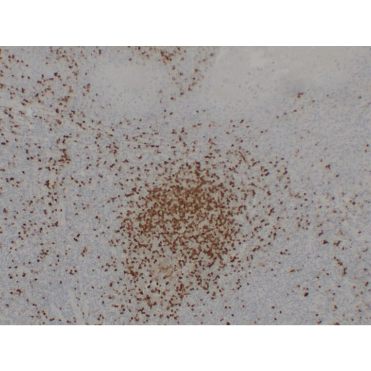 Immunohistochemistry - Anti-TCL1 Antibody (V0128) - Antibodies.com