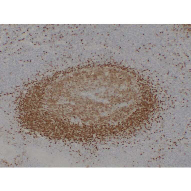 Immunohistochemistry - Anti-TCL1 Antibody (V0128) - Antibodies.com