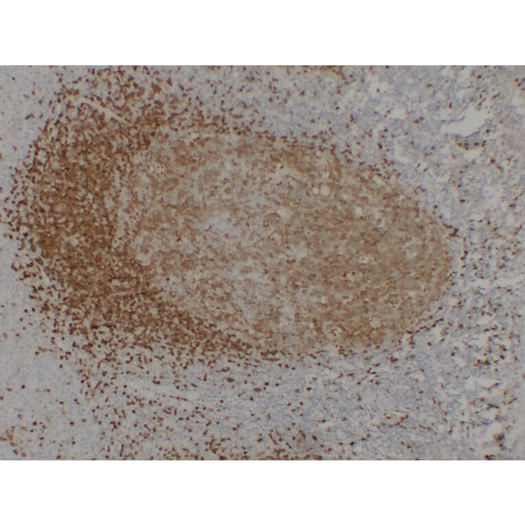 Immunohistochemistry - Anti-TCL1 Antibody (V0128) - Antibodies.com