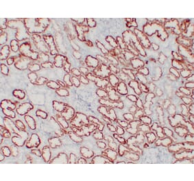 Immunohistochemistry - Anti-pVHL Antibody (V0120) - Antibodies.com