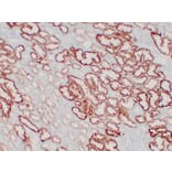 Immunohistochemistry - Anti-pVHL Antibody (V0120) - Antibodies.com
