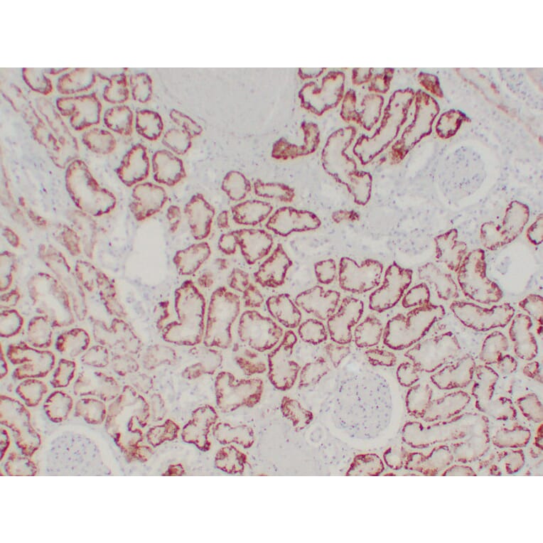 Immunohistochemistry - Anti-pVHL Antibody (V0120) - Antibodies.com
