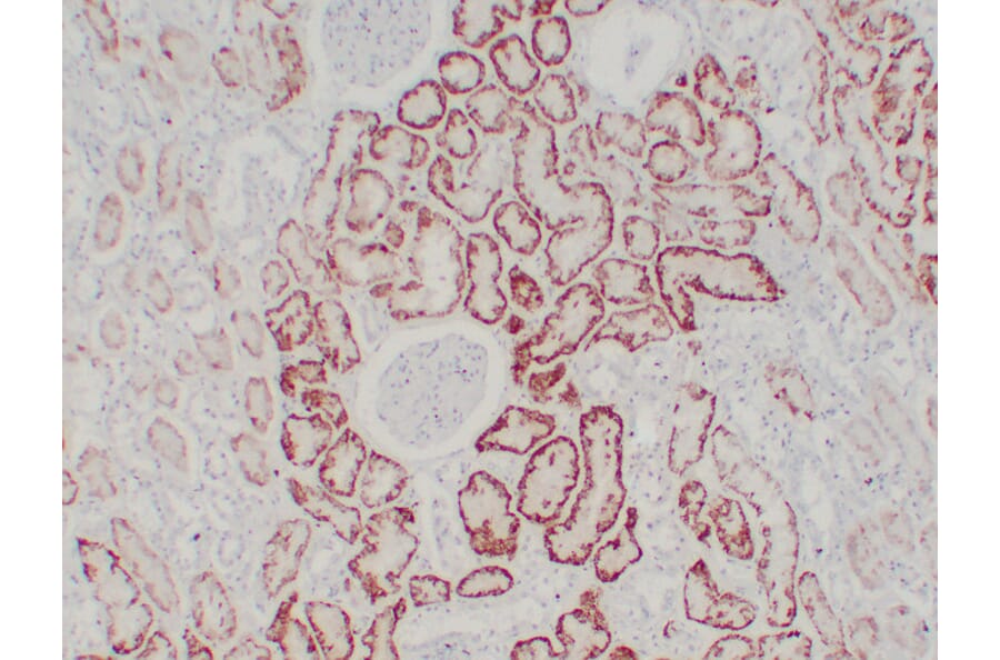 Immunohistochemistry - Anti-pVHL Antibody (V0120) - Antibodies.com