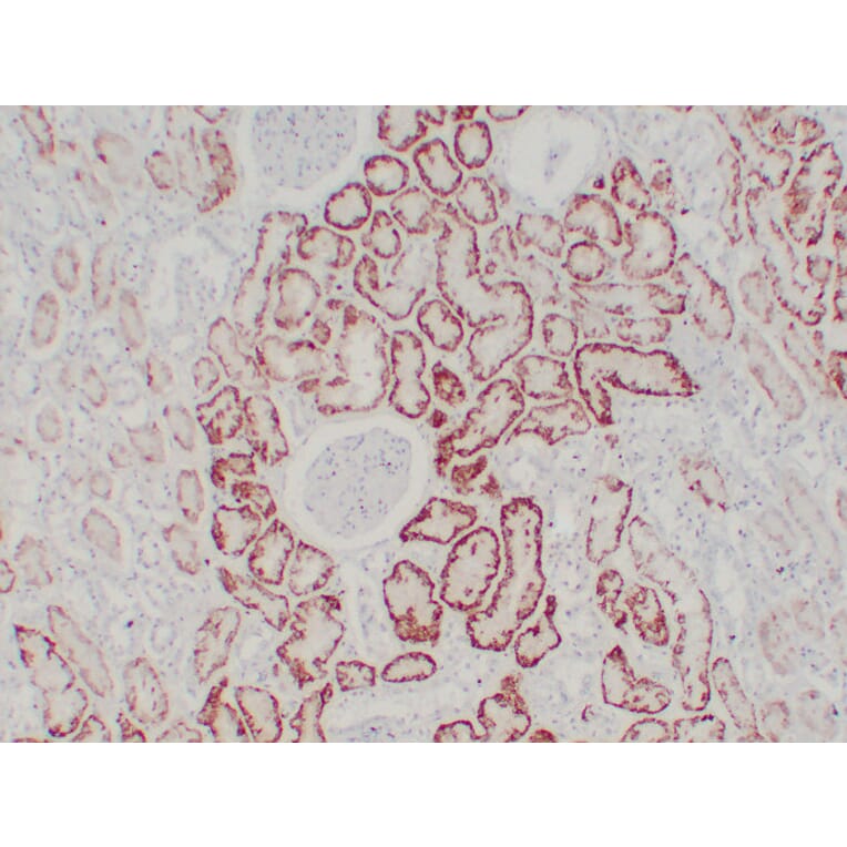 Immunohistochemistry - Anti-pVHL Antibody (V0120) - Antibodies.com