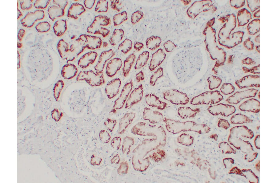 Immunohistochemistry - Anti-pVHL Antibody (V0120) - Antibodies.com