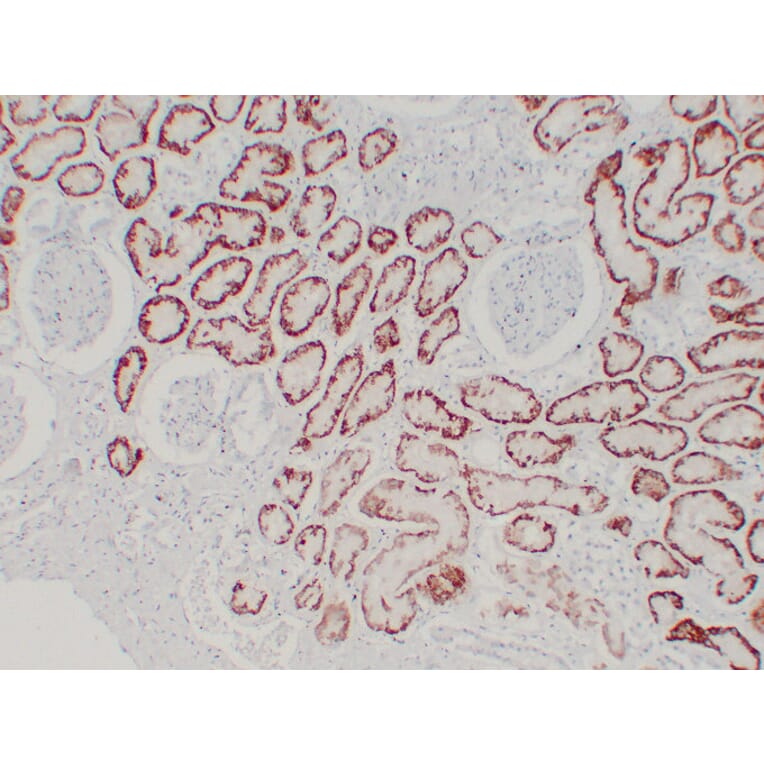 Immunohistochemistry - Anti-pVHL Antibody (V0120) - Antibodies.com