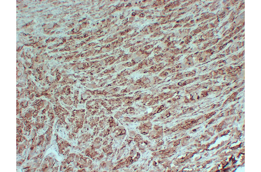 Immunohistochemistry - Anti-PMEL Antibody (V0113) - Antibodies.com