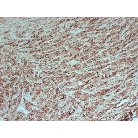 Immunohistochemistry - Anti-PMEL Antibody (V0113) - Antibodies.com
