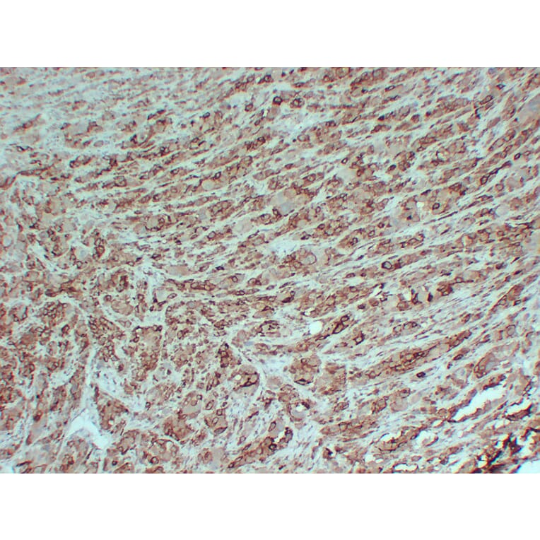 Immunohistochemistry - Anti-PMEL Antibody (V0113) - Antibodies.com