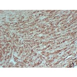 Immunohistochemistry - Anti-PMEL Antibody (V0113) - Antibodies.com