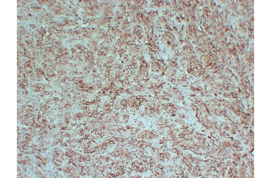 Immunohistochemistry - Anti-PMEL Antibody (V0113) - Antibodies.com