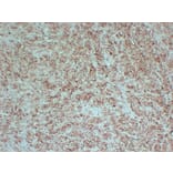 Immunohistochemistry - Anti-PMEL Antibody (V0113) - Antibodies.com