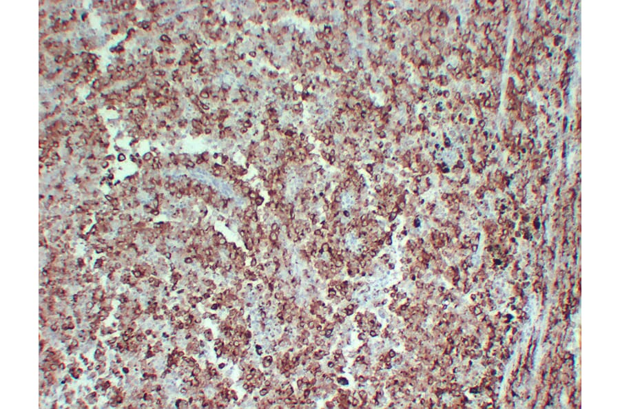 Immunohistochemistry - Anti-PMEL Antibody (V0113) - Antibodies.com