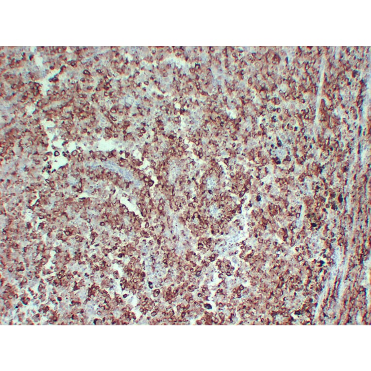 Immunohistochemistry - Anti-PMEL Antibody (V0113) - Antibodies.com