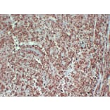 Immunohistochemistry - Anti-PMEL Antibody (V0113) - Antibodies.com